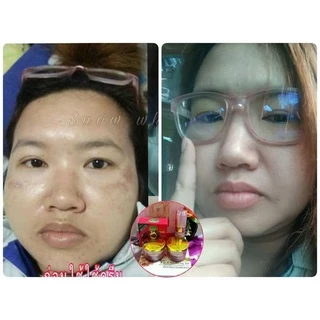ครีมสโนไวท์ของแท้100%1ชุดประกอบด้วย4ชิ้น💐(เซรั่ม,ครีมกลางวัน,ครีมกลางคืน,สบู่)