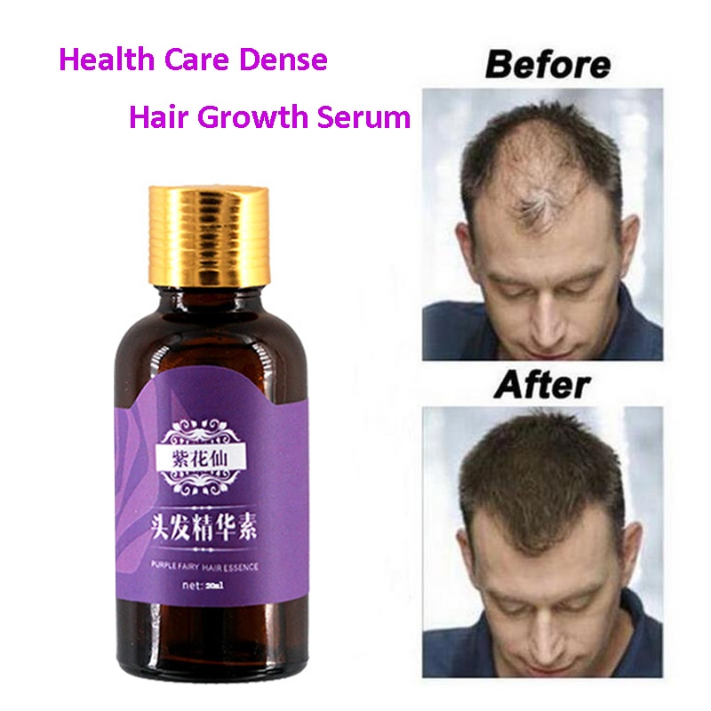 20ml Fast Hair Growth Faster Grow Hair Regrowth For Men Women Pure Natural  Hair Loss Products Pilatory Treatment Anti-Ha | Shopee Thailand