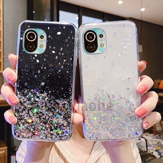 เคสโทรศัพท์ Xiaomi Mi 11 Lite Starry sky Soft tpu Phone case Xiomi Mi 11 Lite Housing shell