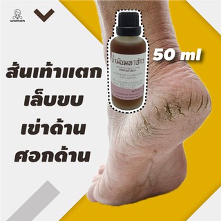 ทาส้นเท้าแตก ข้อศอกด้าน เข่าด้าน เล็บขบ เป็นหนอง จักกะแร้ดำ 50 ml
