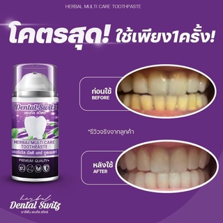 เจลฟอกฟันขาวdental switz  เจลฟอกฟัน  ฟันขาว  ยาสีฟันขาว (1แถม 1)