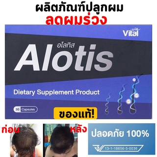 🔥ใส่ AIM817PA ลด99฿🔥alotis ยาปลูกผม ขนาด30แคปซูล ช่วยลดการหลุดร่วงของเส้นผม สร้าเส้นผมใหม่ให้แข็งแรง