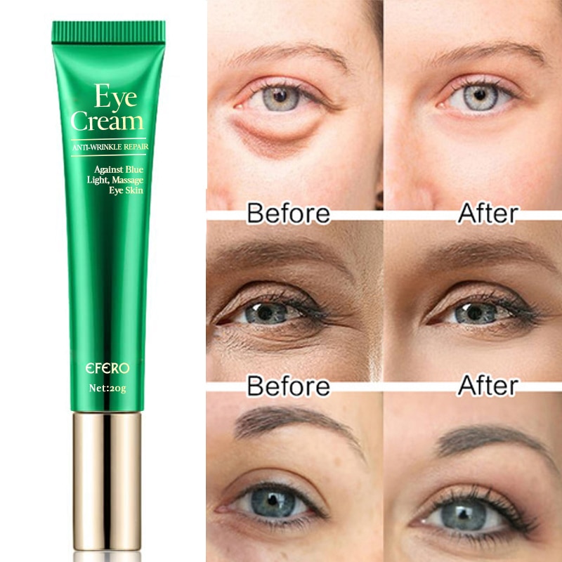 eye cream for fine lines