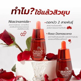 💥พร้อมส่ง ส่งฟรีไม่ต้องใช้โค้ด💥MATANA เซรั่มลดสิวริ้วรอย ฝ้ากระ เพิ่มความฉ่ำน้ำ