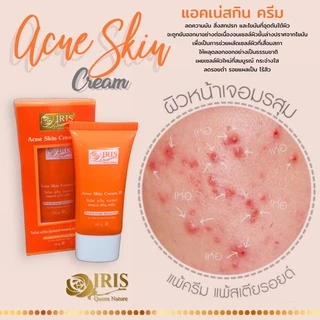 ไอริส ควีน เนเจอร์/iris/แอคเน่ สกิน ครีม สูตร 3 /หน้าใส/ลดมัน/แพ็กเกจใหม่