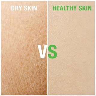 [สินค้าขายดี] Smooth E White Skin Therapie Body Lotion 100 / 200 ml โลชั่นบำรุงผิว สูตรเข้มข้น ผิวกระจ่างใส ผิวเนียนนุ่ม