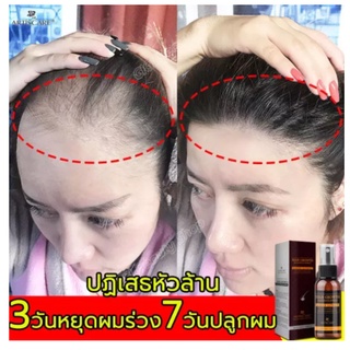 ARTISCARE ดูแลเส้นผม น้ำมันดูแลผม สมุนไพรธรรมชาติ รักษาผมร่วง รักษาเส้นผม Hair Growth Essence Spray Anti Hair