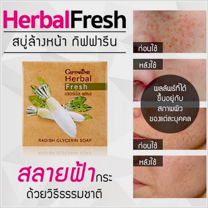 สบู่ล้างหน้า ผสมหัวไชเท้า กิฟฟารีน Herbal Fresh Radish Glycerin Soap GIFFARINE ลดเลือน สิว ฝ้า กระ