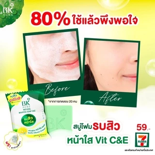 (1 ก้อน) สูตรใหม่ สบู่ บีเค แอคเน่ รบสิวหน้าใส Vit C&E BK Acne Natural Whipped Soap C&E