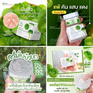 เซรั่ม ใบบัวบก ว่านหางจระเข้ พักหน้ารักษาสิว ผิวแข็งแรง Serum Centella Asiatica 98% Pontina ช่วยปลอบประโลมผิวที่แพ้ง่าย