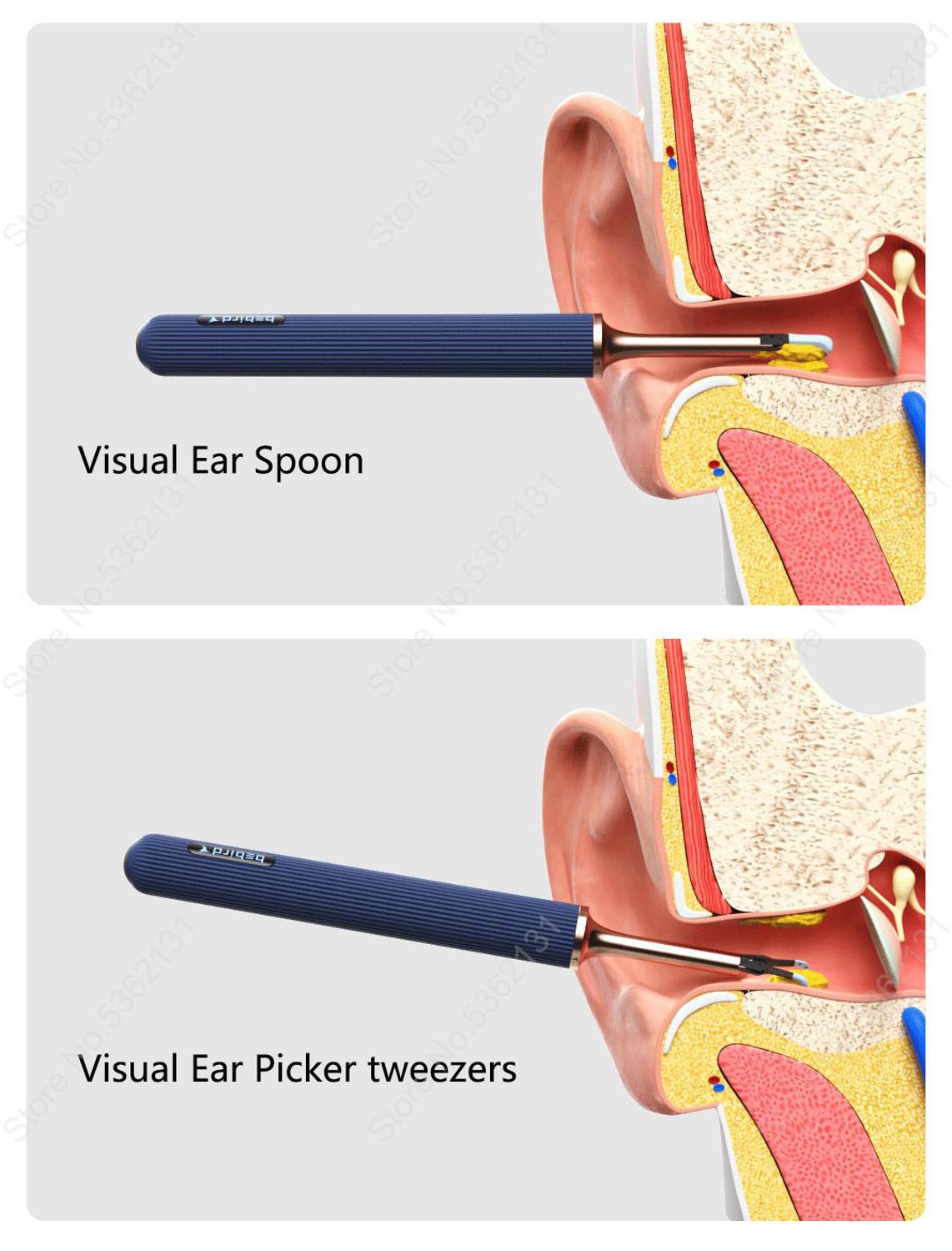 Youpin Bebird Note 3 Intelligent Visual Ear Stick 1000W Ear Cleaning ...