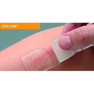 แผ่นซิลิโคน เจลชีท CICA-CARE ลดรอยแผลเป็น cica care สำหรับแผลเป็นที่มีลักษณะนูนแดง มี3ขนาด - รูปที่ 6