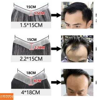 ส่งจากลพบุรี วิกผมชาย เส้นผมวิกผมสติกเกอร์ ผมแท้ ผมจริง ไม่เห็นร่องรอยปลอมหลิว ไห่mสูงหน้าผาก ผู้ชายหน้าผากทดแทนแผ่น