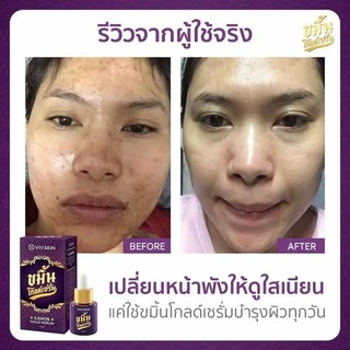 🔥โปรเซ็ต 2 ชิ้น‼️ ของแท้💯 VIV SKIN เซ็ตขมิ้น สูตร ORIGINAL (เซรั่ม + ครีม) วิฟสกิน ครีมจุ๋ย