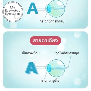 ราคาโปร - ตัดแว่น ค่าสายตาเอียง