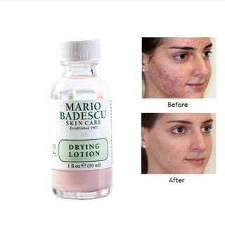 Mario Badescu/mb โลชั่นรักษาสิว ป้องกันสิว สิว สิวเสี้ยน กําจัดสิว 29 มล.