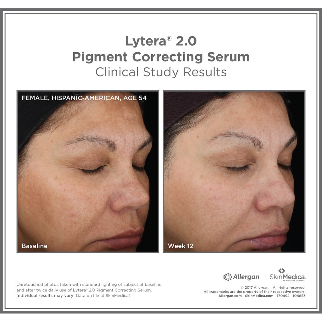 pigment correcting serum