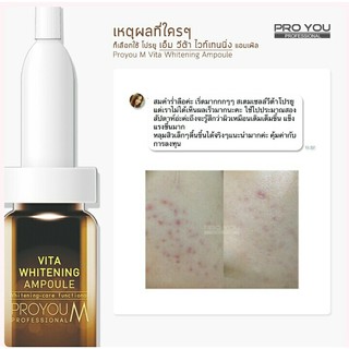 PRO YOU M Vita Whitening Ampoule 8ml (เซรั่มเข้มข้นที่ช่วยลดเลือนจุดด่างดำ ปรับผิวหน้าให้ขาวขึ้น)