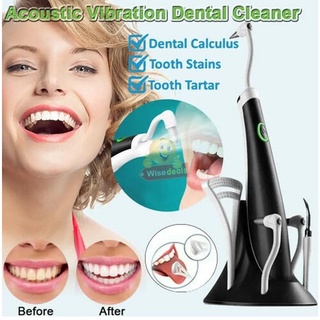 Superhomeshop เครื่องทำความสะอาดฟัน ที่ขูดหินปูน ซอกฟัน ขัดฟัน 5 in 1 รุ่น Acoustic Vibration Tooth Cleaner-8Feb-J1