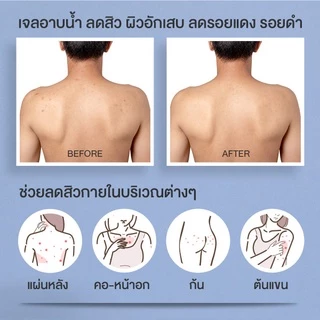 Kraam Acne Clear Body Wash Orange Seed & Salicylic Acid เจลอาบน้ำลดสิวกาย 450 ml