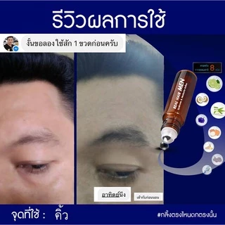 ของแท้!!! Real Hair- เซรั่มปลูกผม คิ้ว หนวด จอน -(สูตรหัวเชื้อ) ใช้ได้ทั้ง ช ญ