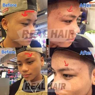 Real Hair- เซรั่มปลูกผม คิ้ว หนวด จอน -(สูตรหัวเชื้อ) ใช้ได้ทั้ง ช ญ