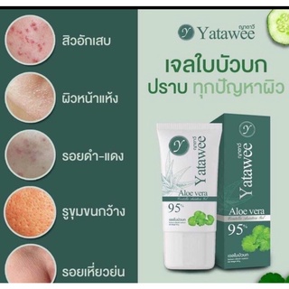 เจลใบบัวบก เจลญาตาวี ญาตาวี yatawee ยาตาวี ลดสิว ลดการอักเสบ ผิวแพ้ง่ายใช้ได้ คนท้องใช้ได้