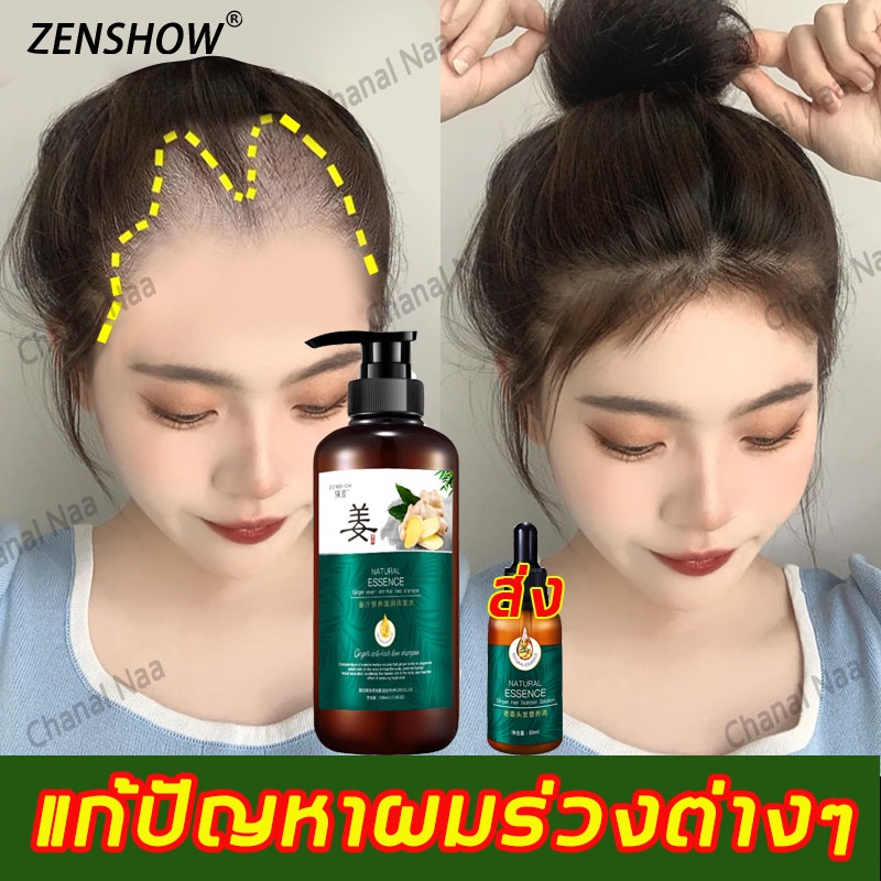 ซื้อ 1 แถม 1 แชมพูแก้ผมร่วง ZHENSHOW แชมพูขิง 500ML เซรั่มปลูกผม