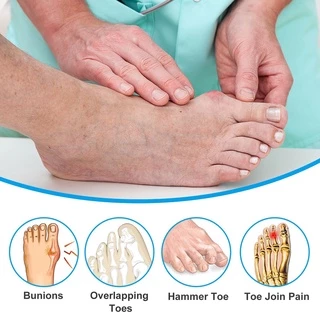 แหวนซิลิโคนแยกนิ้วเท้า Hallux Valgus 0 Over อุปกรณ์ดูแลเท้า
