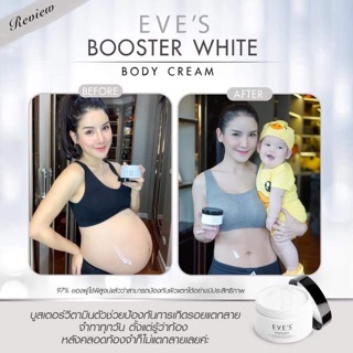 ขายดีที่สุด ❗️ EVE’S BOOSTER ครีมวิตามินสูตรเข้มข้น ป้องกันผิวแตกลาย ปลอดภัยกับคนท้อง และให้นมบุตร