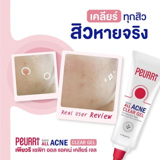 **หมดอายุ04/22 Peurri Rapid All Acne Clear Gel 8g / wash