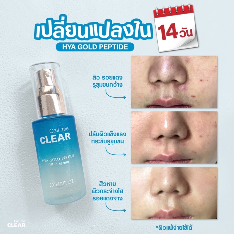 Call me Clear ตัวช่วยหน้าแหก จากผู้ใช้จริง ซื้อซ้ำกว่า 90%