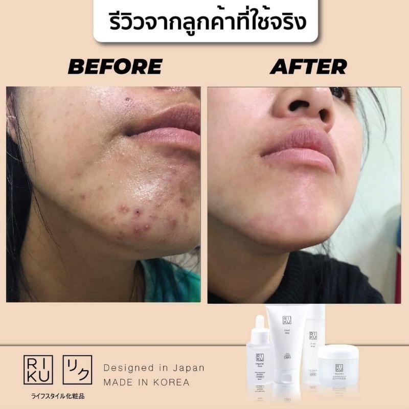 ⚡️โฟม⚡️🌈พร้อมส่ง โฟมล้างหน้า Riku ริคุ โฟมน้ำนมแรก ลดมัน ลดสิว ผิวกระจ่างใส First  Milk Face Cleanser เกาหลี Korea - รูปที่ 5