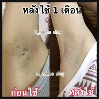 ครีมทารักแร้โออัจชา15กรัม(มีราคาส่ง)