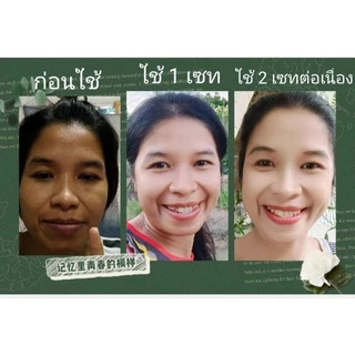 ครีมสโนไวท์ของแท้100%1ชุดประกอบด้วย4ชิ้น💐(เซรั่ม,ครีมกลางวัน,ครีมกลางคืน,สบู่)