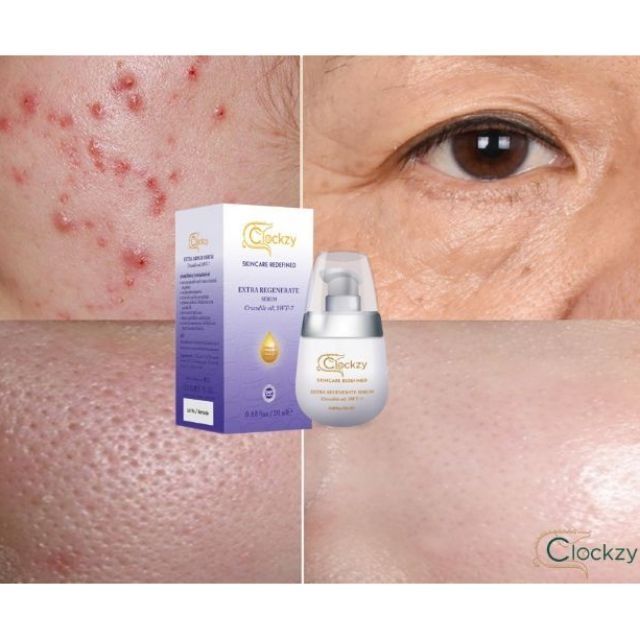 เซรั่ม ลดรอยสิว (1แถม1สุดคุ้ม) ลดริ้วรอย หน้าใส หน้าดูอ่อนวัย ลดริ้วรอย ...