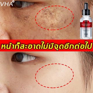 VHA ครีมทาฝ้า ครีมฝ้ากระ 30ml ครีมทาผิวขาว ไวท์เทนนิ่ง ครีมถาหน้าขาว ไวท์เทนนิ่งกระ ครีมรักษาฝ้า ครีมทาฝ้ากระ