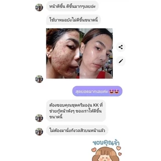 ครีมองุ่น K&K [ จำหน่ายของแท้ 100% ]