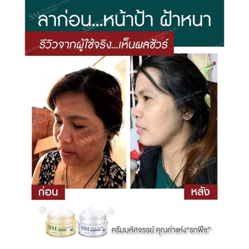 ✅ [ส่งฟรี+ส่วนลด] เซตครีมรกพืชเอสเอ็ม SM 15 g. #SM Skincare#เอสเอ็ม สกินแคร์ thumbnail 8