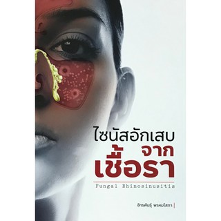 (ศูนย์หนังสือจุฬาฯ) ไซนัสอักเสบจากเชื้อรา (FUGAL RHINOSINUSITIS) (9786165828758)