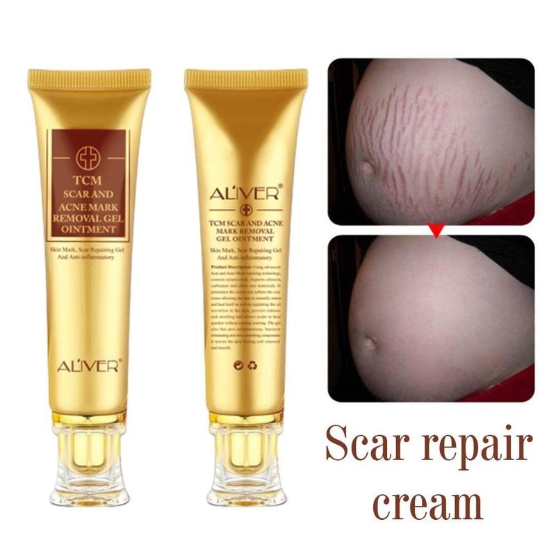 fast acne scar removal cream