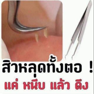 คีมกดสิว