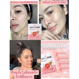 Renatar aura plus เราต้า ออร่า พลัส วิตามินบำรุงผิว ขจัดสารพิษจากร่างกาย