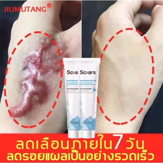 ครีมลดแผลเป็นอย่างมืออาชีพ JIUMUTANG ครีมลบแผลเป็น ซ่อมแซมแผลเป็นทุกชนิด สำหรับแผลเป็นนูนหนา