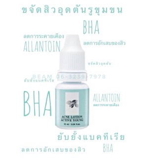 โลชั่นแต้มสิว แอคทีฟ ยัง กิฟฟารีน GIFFARINE ACTIVE YOUNG ACNE LOTION