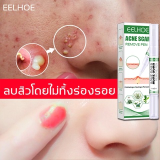 EELHOE ครีมกำจัดสิว รีแพร์ครีมแต้มสิว ครีมแต้มสิวยันฮี แต้มสิว ช่วยลดสิว ลดรอยแดงและบวม กระชับรูขุมขน และเนื้อเจลใ