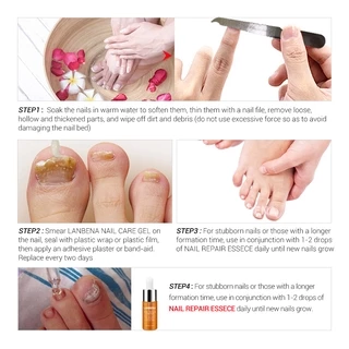 LANBENA Nail Repair Essence 15ml น้ำตบบำรุงเล็บ ซ่อมแซมเล็บเสีย ฟื้นฟูให้ขาวใส บำรุงมือและเล็บเท้า