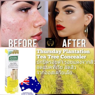 Thursday Plantation tea tree oil concealer blemish stick คอนซีลเลอร์ ทีทรีออย ปกปิดรอยสิว จากออสเตรียเลีย แท้100% ลดสิว