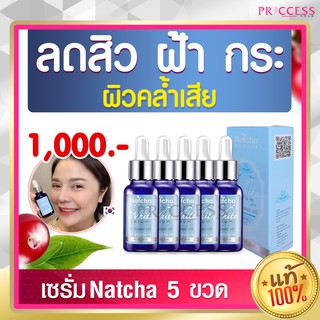 แพ็ค 5 ขวด เซรั่มณัชชา NATCHA ของแท้ 100%  เซรั่ม รักษาฝ้า สิว กระ จุดด่างดำ  30ml ส่งฟรี