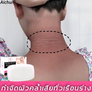 Aichun 100g สบู่ล้างหน้า ลดสิวสบู่ ชุ่มชื่น สบู่ต้านเชื้อรา การดูแลผิว สบู่ไวท์เทนนิ่ง